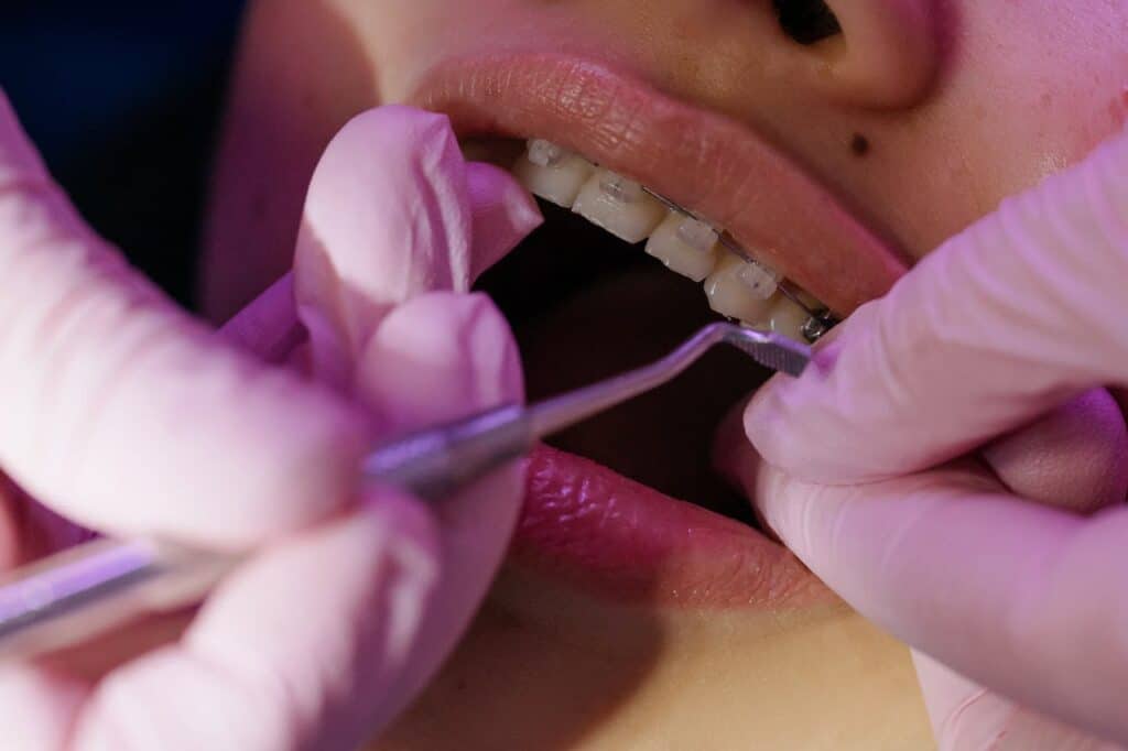 cuándo es necesario un tratamiento de ortodoncia