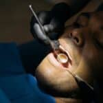 diferencia entre carillas y fundas dentales