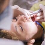 qué hacer cuando se sufre una fractura dental
