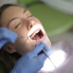 qué problemas pueden ocasionar los implantes dentales