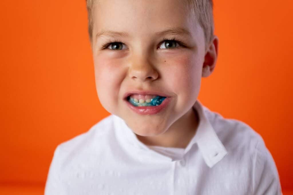 qué provoca la aparición de caries en los niños