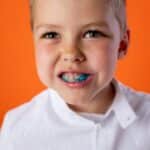 qué provoca la aparición de caries en los niños