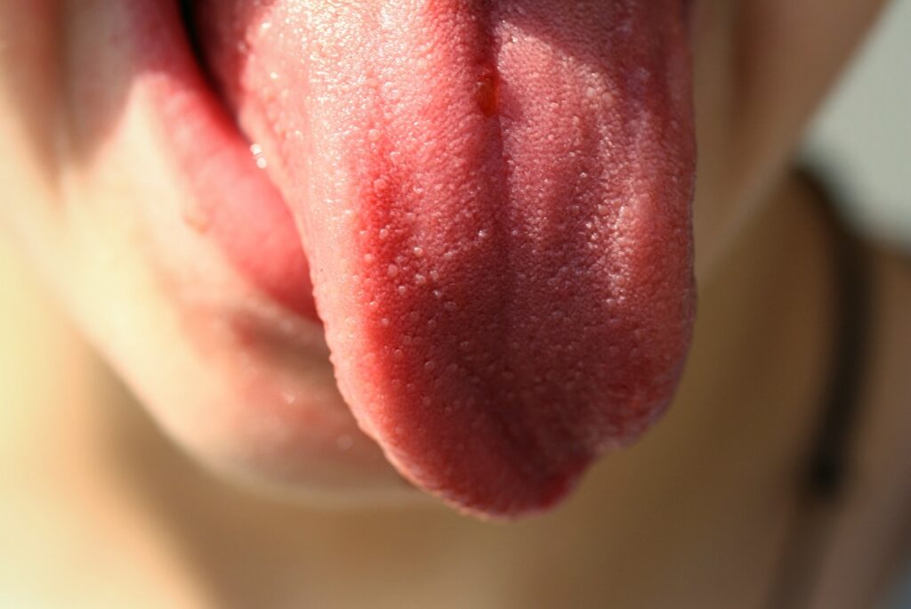 causas y remedios para la lengua amarilla