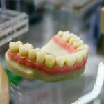 tipos de blanqueamiento dental