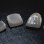 implantes de carga inmediata