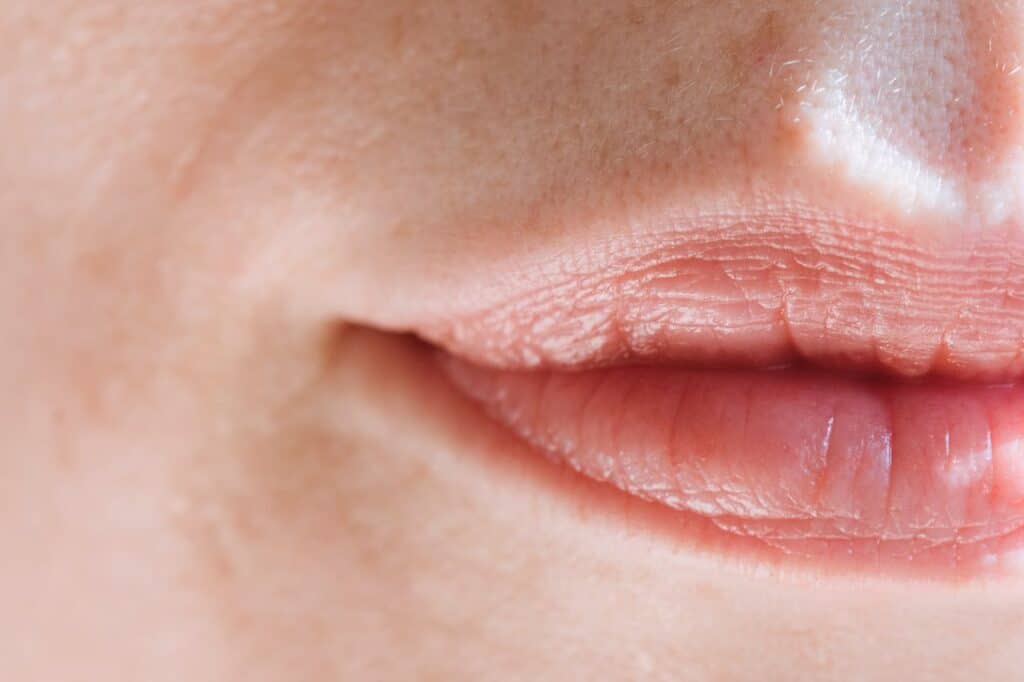 qué causa las llagas en la boca