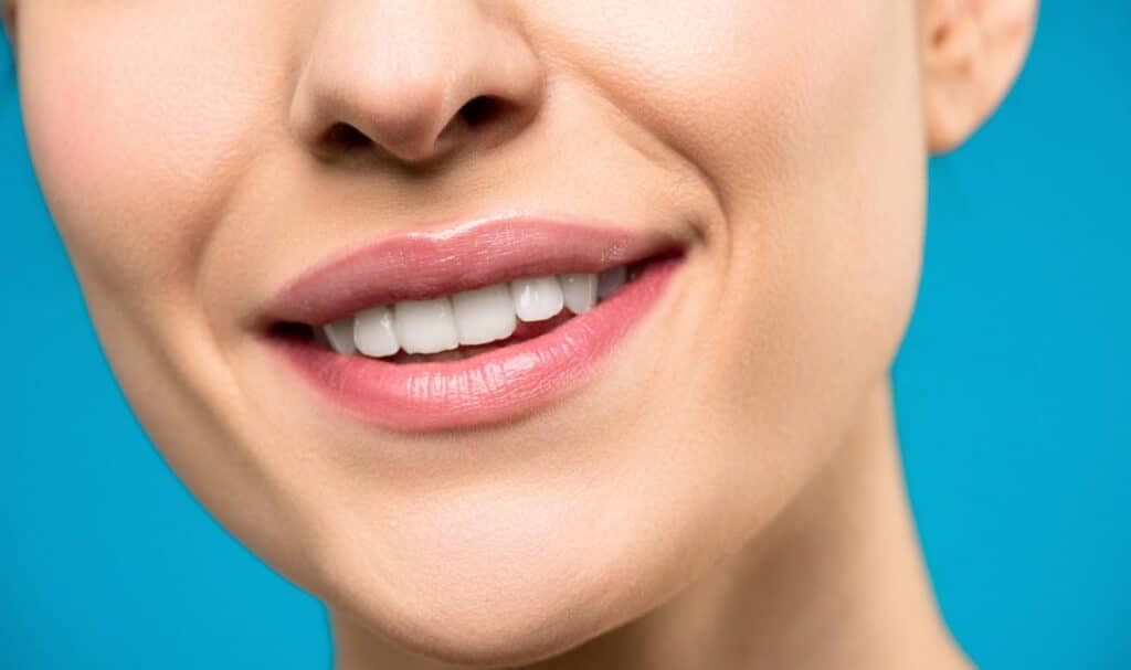Blanqueamiento dental Las Fuentes