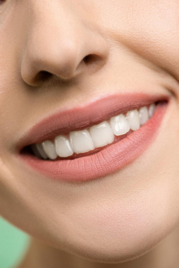 Blanqueamiento dental Montañana