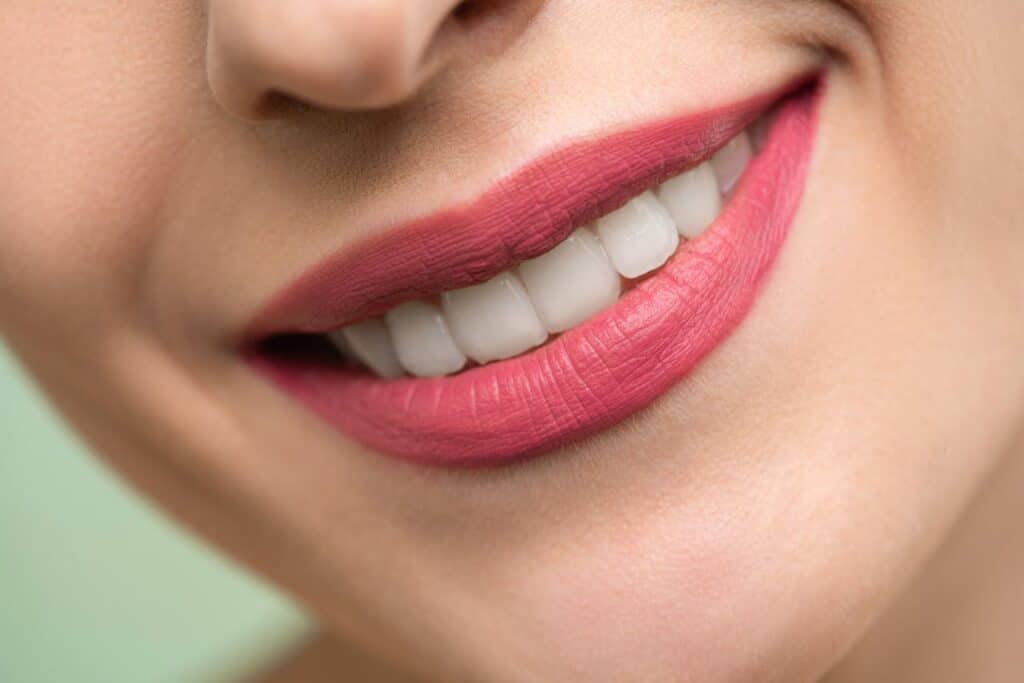 Blanqueamiento dental Oliver-Valdefierro