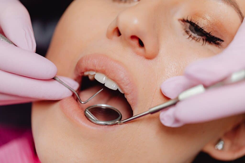 Empastes dentales Montecanal