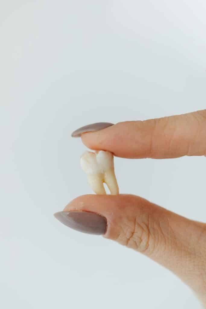 Extracciones dentales Almozara