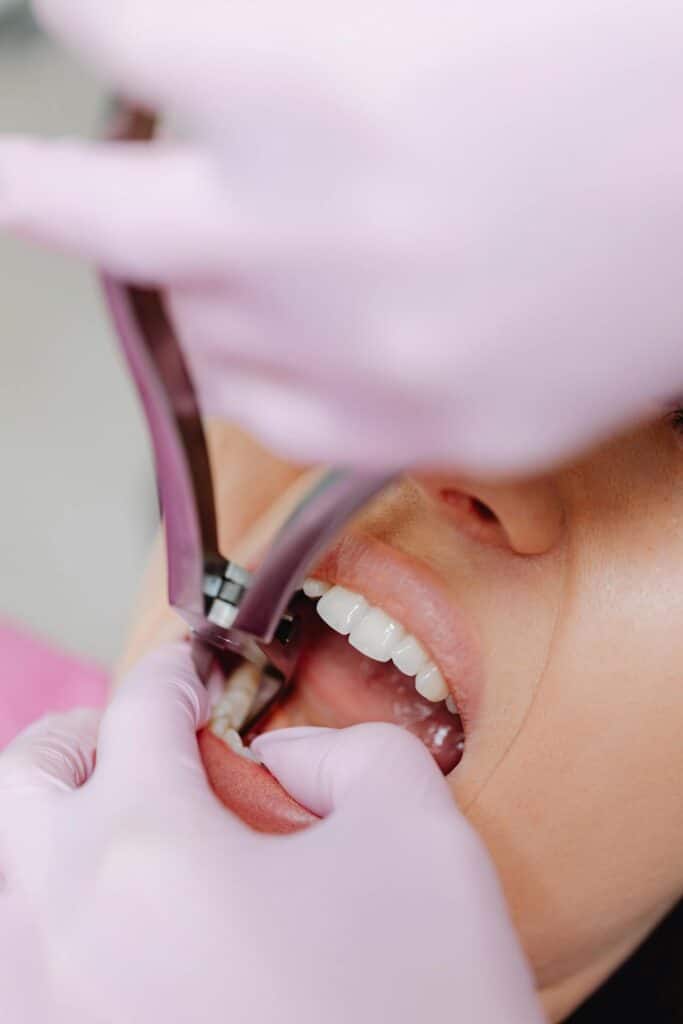 Extracciones dentales Peñaflor