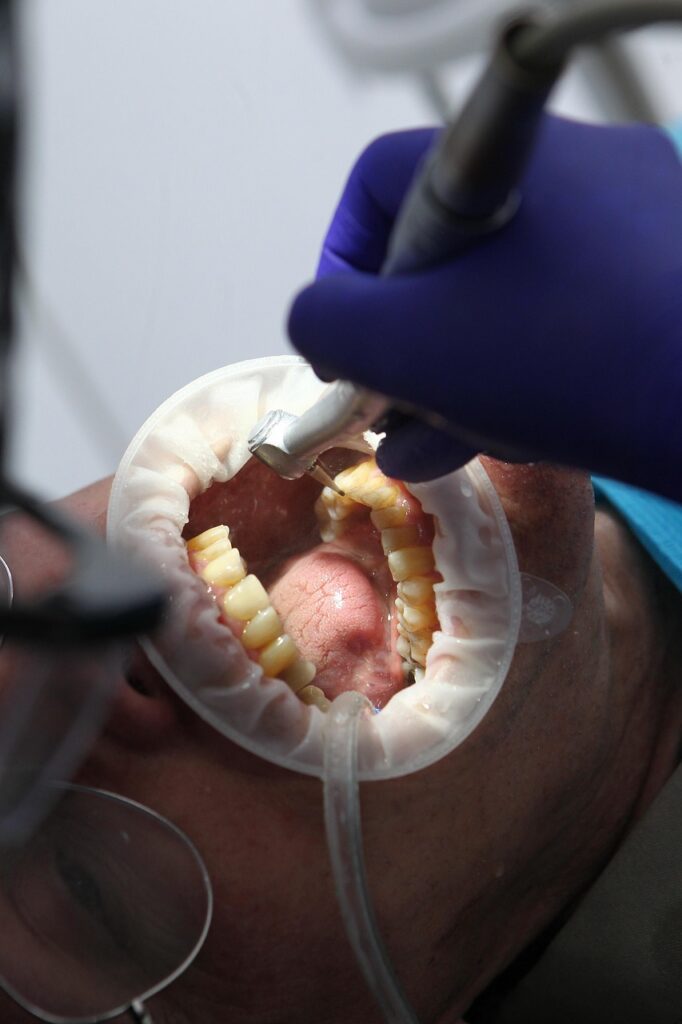 Limpieza dental Casablanca