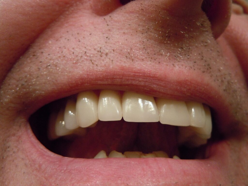 Limpieza dental San Juan de Mozarrifar