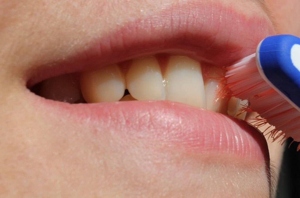 Limpieza dental Valdespartera