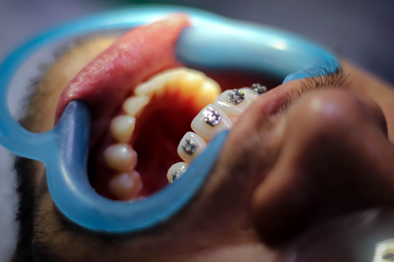 Ortodoncia y la salud bucodental